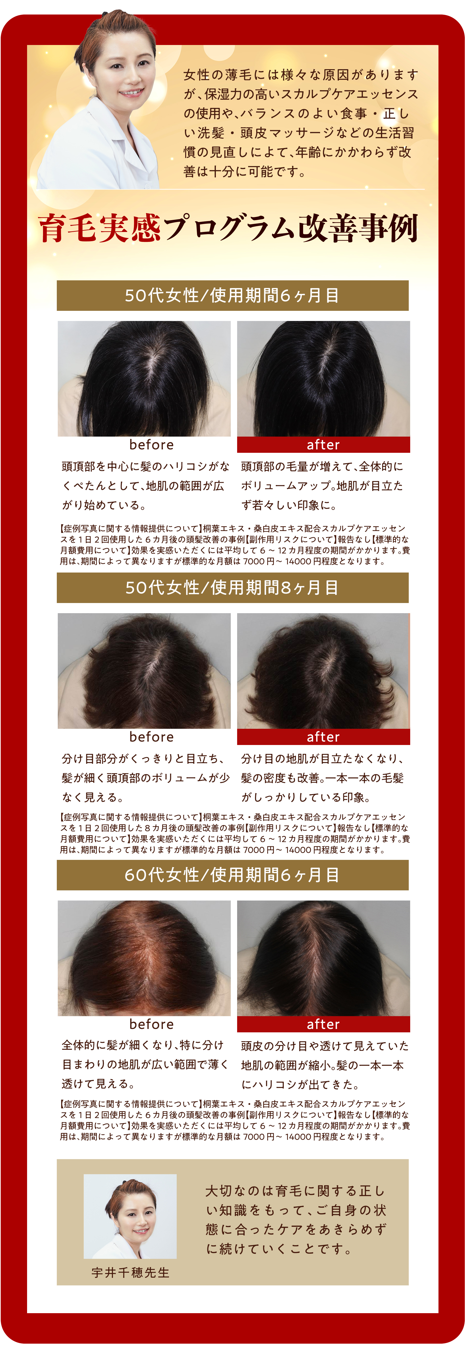 育毛実感プログラム改善事例